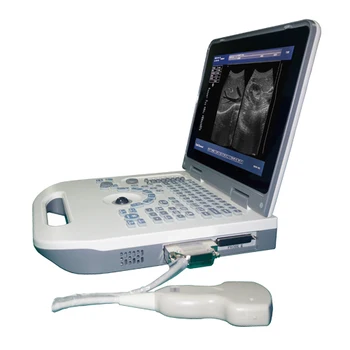 Debelo Po Meri Dobre Kakovosti Mini Pralni Laptop Uporabo V Veterinarski Prenosni Ultrazvok