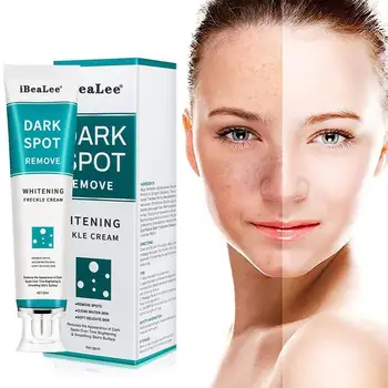 Beljenje Freckle Krema Za Obraz Vlažilno Odstraniti Temne Lise Melasma Odstranjevalec Osvetlitev Kože Učinkovito Popravilo Anti-Aging