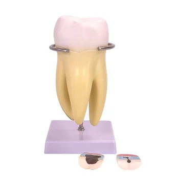 Snemljivo Veliko Molarno Model PVC Prenosna In Praktična Živo Malte Zob Anatomski Model Vizualne učne Plesni