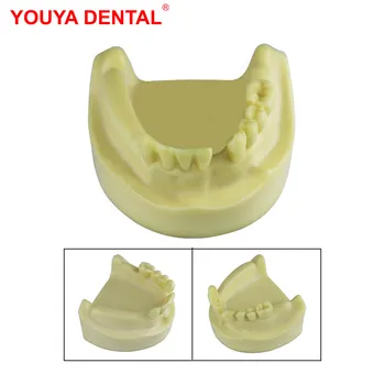 Spodnja Čeljust Zobozdravstvene Prakse Model Vsadek Modela Manjkajočih Zob Zob Model Za Usposabljanje Examation Študij Izobraževanje, Poučevanje Demo