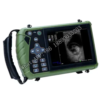 KBW-V6 Palm Ultrazvok Scanner(ultrasonicblack whiteImaging Sistem)