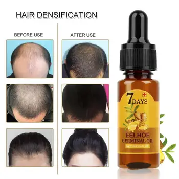 Ingver Rast Las, Eterično Olje, Naravni Anti Hair Loss Hitro Rastočih Preprečevanje Suhe Lase Kovrčav Popravilo Poškodovanih Izdelkov za Nego 40ml